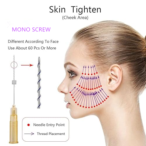 Sunhing PDO Mono Screw Thread - Image 3